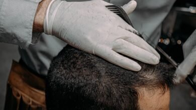 Hair Transplant